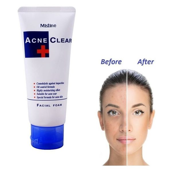 Mistine Acne Clear Face Wash Facial Foam 85 M